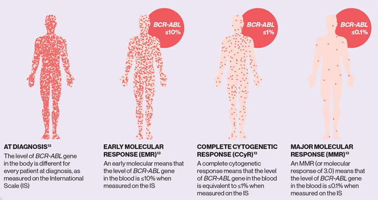 What are the treatment milestones in CML